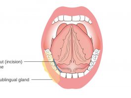 sublingual cbd consumption